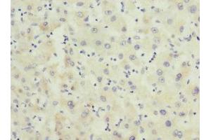 Immunohistochemistry of paraffin-embedded human liver tissue using ABIN7153138 at dilution of 1:100 (FHL3 antibody  (AA 1-280))