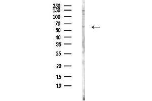 Western blot analysis of lysates from MC-3-E1 cells, using CHRND Antibody at 1/1000 dilution.