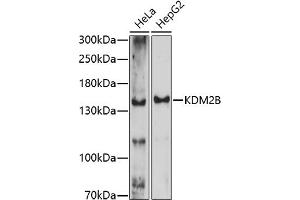 Western blot analysis of extracts of various cell lines, using KDM2B antibody (ABIN7268327) at 1:1000 dilution. (KDM2B antibody  (AA 600-700))