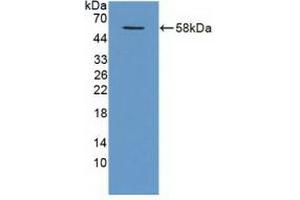 Detection of Recombinant TRAF1, Human using Polyclonal Antibody to TNF Receptor Associated Factor 1 (TRAF1) (TRAF1 antibody  (AA 131-381))