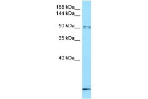 WB Suggested Anti-Fbxo11 Antibody   Titration: 1.