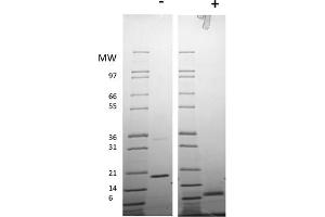 SDS-PAGE of Human Resistin Dimer Recombinant Protein SDS-PAGE of Human Resistin Dimer Recombinant Protein. (Resistin Dimer Protein)