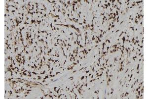 ABIN6273180 at 1/100 staining Human gastric tissue by IHC-P. (TARBP2 antibody  (Internal Region))