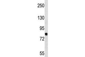 Dyrk1a antibody western blot analysis in NCI-H460 lysate. (DYRK1A antibody  (AA 718-745))