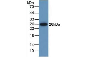 Detection of Recombinant MUSK, Mouse using Polyclonal Antibody to Muscle, Skeletal, Receptor Tyrosine Kinase (MUSK) (MUSK antibody  (AA 517-777))