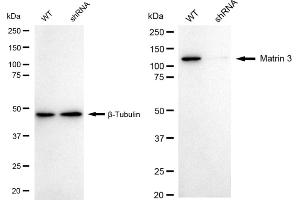 Western blotting analysis using Matrin 3 antibody (ABIN7799337).