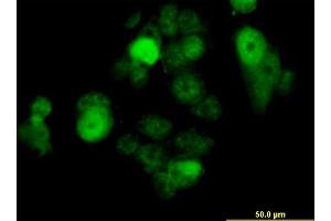 Immunofluorescence of monoclonal antibody to SOX30 on MCF-7 cell. (SOX30 antibody  (AA 644-753))