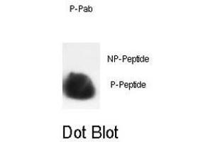 Dot blot analysis of HIST1H3B3 (phospho S10) polyclonal antibody  on nitrocellulose membrane.