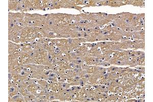 ABIN6257419 and ABIN6273804 at 1/100 staining mouse brain tissue by IHC-P.