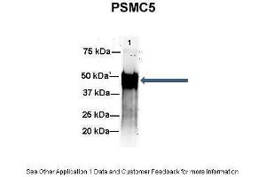 Amount and Sample Type :  500 ug mouse brain homogenate  Amount of IP Antibody :  6 ug  Primary Antibody :  PSMC5  Primary Antibody Dilution :  1:500  Secondary Antibody :  Goat anti-rabbit Alexa-Fluor 594  Secondary Antibody Dilution :  1:5000  Gene Name :  PSMC5  Submitted by :  Dr. (PSMC5 antibody  (C-Term))