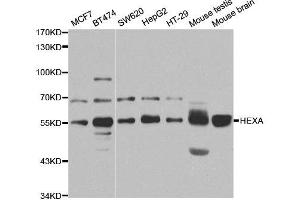 Western Blotting (WB) image for anti-Hexosaminidase A (HEXA) antibody (ABIN1876847)
