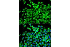 Immunofluorescence analysis of MCF-7 cells using EIF4A1 antibody. (EIF4A1 antibody  (AA 1-406))