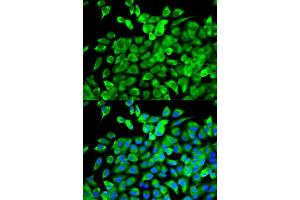 Immunofluorescence analysis of MCF-7 cells using EIF4A1 antibody. (EIF4A1 antibody  (AA 1-406))