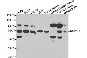 Western blot analysis of extracts of various cell lines, using RUVBL1 antibody. (RUVBL1 antibody)