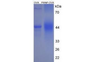 Image no. 3 for Procollagen III N-Terminal Propeptide (PIIINP) (N-Term) peptide (Ovalbumin) (ABIN5666357) (Procollagen III N-Terminal Propeptide (PIIINP) (N-Term) peptide (Ovalbumin))
