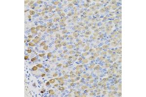 Immunohistochemistry of paraffin-embedded mouse stomach using LDHB antibody (ABIN5975613) at dilution of 1/100 (40x lens). (LDHB antibody)