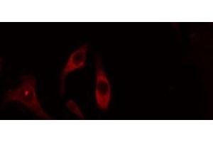 ABIN6275086 staining Hela cells by IF/ICC. (DZIP3 antibody  (Internal Region))