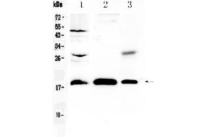 Western blot analysis of TMEM240 using anti- TMEM240 antibody .