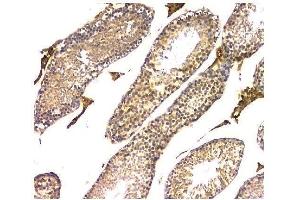 IHC analysis of WWOX using anti-WWOX antibody (ABIN6719627). (WWOX antibody  (AA 1-245))