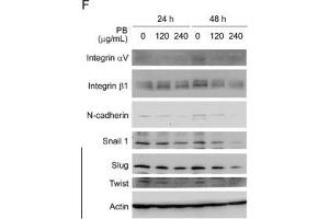 PB downregulates several proteins related to cell cycle progression, morphology, cell-cell adhesion and cell migration. (SNAIL antibody)