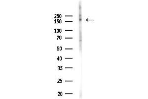 Western blot analysis of lysates from MCF7 cells(heat-shock,45 min treatment), using SNAPC4 Antibody at 1/1000 dilution.