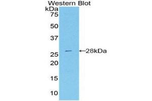 Western Blotting (WB) image for anti-DEAD (Asp-Glu-Ala-Asp) Box Polypeptide 58 (DDX58) (AA 1-211) antibody (ABIN3206479) (DDX58 antibody  (AA 1-211))