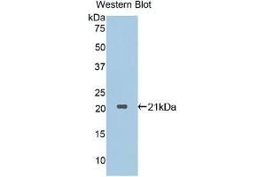 Detection of Recombinant PR3, Human using Polyclonal Antibody to Proteinase 3 (PR3) (PRTN3 antibody  (AA 71-247))