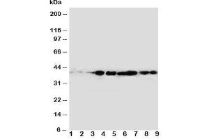 Western blot testing of CrkL antibody and rat samples 1: spleen;  2: ovary;  3: testis; and human samples 4: MM231;  5: A431;  6: MCF-7;  Lane 7;  MM231;  8: MM543;  9: Jurkat cell lysate. (CrkL antibody  (AA 286-303))