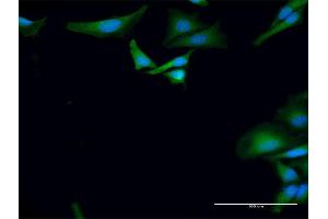 Immunofluorescence of purified MaxPab antibody to BTRC on HeLa cell. (BTRC antibody  (AA 1-605))