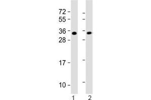 Western blot testing of 1) mouse heart and 2) rat PC-12 lysate with SLUG antibody. (SLUG antibody  (AA 98-129))