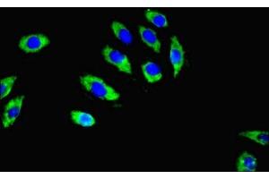 Immunofluorescent analysis of A549 cells using ABIN7167605 at dilution of 1:100 and Alexa Fluor 488-congugated AffiniPure Goat Anti-Rabbit IgG(H+L) (RGS2 antibody  (AA 1-241))