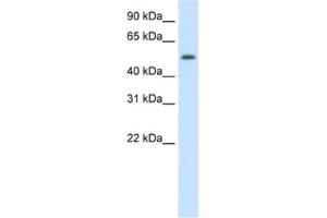 Western Blotting (WB) image for anti-Death Inducer-Obliterator 1 (DIDO1) antibody (ABIN2461922) (DIDO1 antibody)