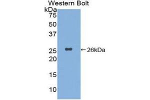 Western Blotting (WB) image for anti-Xeroderma Pigmentosum, Complementation Group C (XPC) (AA 734-933) antibody (ABIN1860965) (XPC antibody  (AA 734-933))