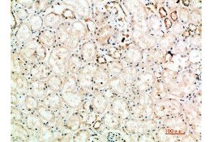 Immunohistochemical analysis of paraffin-embedded human-kidney, antibody was diluted at 1:200 (CTLA4 antibody  (AA 41-90))