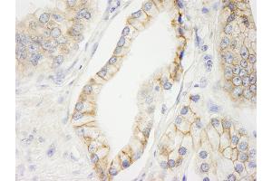 Immunohistochemistry (IHC) image for anti-C2 Calcium Dependent Domain Containing 5 (C2CD5) (AA 375-425) antibody (ABIN7448623) (C2CD5/KIAA0528 antibody  (AA 375-425))