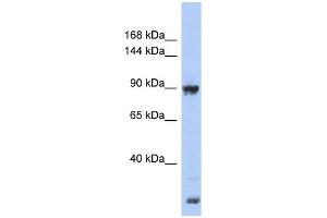 URG4 antibody used at 1 ug/ml to detect target protein. (URGCP antibody  (Middle Region))