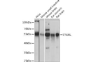Western blot analysis of extracts of various cell lines, using STK38L Rabbit pAb (ABIN7270226) at 1:1000 dilution. (STK38L antibody  (AA 165-464))