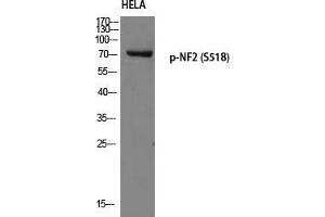 Western Blot (WB) analysis of HeLa using p-NF2 (S518) antibody. (Merlin antibody  (pSer518))