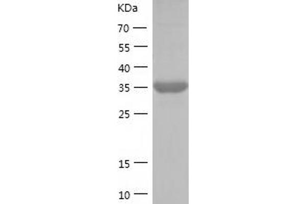 BCAR1 Protein (AA 413-698) (His tag)