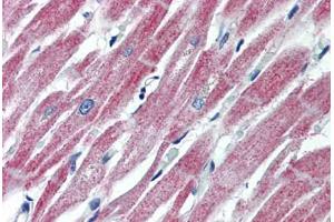 Human Heart (formalin-fixed, paraffin-embedded) stained with MAS1 antibody ABIN462250 followed by biotinylated goat anti-rabbit IgG secondary antibody ABIN481713, alkaline phosphatase-streptavidin and chromogen. (MAS1 antibody  (AA 187-236))
