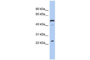 C1ORF190 antibody used at 1 ug/ml to detect target protein. (Chromosome 1 Open Reading Frame 190 (C1orf190) (Middle Region) antibody)