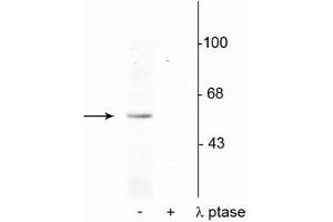 Western blot of rat brain nuclear fraction lysate showing specific immunolabeling of the ~53 kDa p53 phosphorylated at Ser392 in the first lane (-). (p53 antibody  (pSer392))