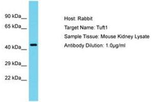 Image no. 1 for anti-Tuftelin 1 (TUFT1) (AA 201-250) antibody (ABIN6750538) (TUFT1 antibody  (AA 201-250))