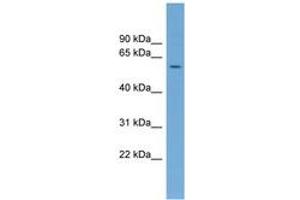 Image no. 1 for anti-serum Amyloid A-Like 1 (SAAL1) (AA 215-264) antibody (ABIN6744983) (SAAL1 antibody  (AA 215-264))