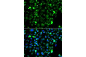 Immunofluorescence analysis of A549 cell using ZAK antibody. (ZAK antibody)