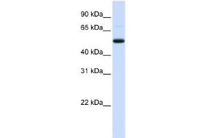 WB Suggested Anti-DCP2 Antibody Titration:  0. (DCP2 antibody  (Middle Region))