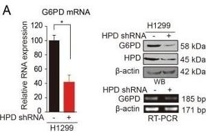 HPD contributes to cell proliferation through upregulation of G6PD. (HPD antibody)