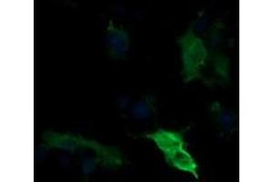 Image no. 1 for anti-Mitogen-Activated Protein Kinase Kinase 1 (MAP2K1) antibody (ABIN1499375) (MEK1 antibody)