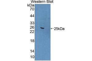 FNBP1 anticorps  (AA 348-529)