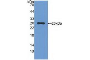 Detection of Recombinant TIGIT, Rat using Polyclonal Antibody to T-Cell Immunoreceptor With Ig And ITIM Domains Protein (TIGIT) (TIGIT antibody  (AA 28-227))